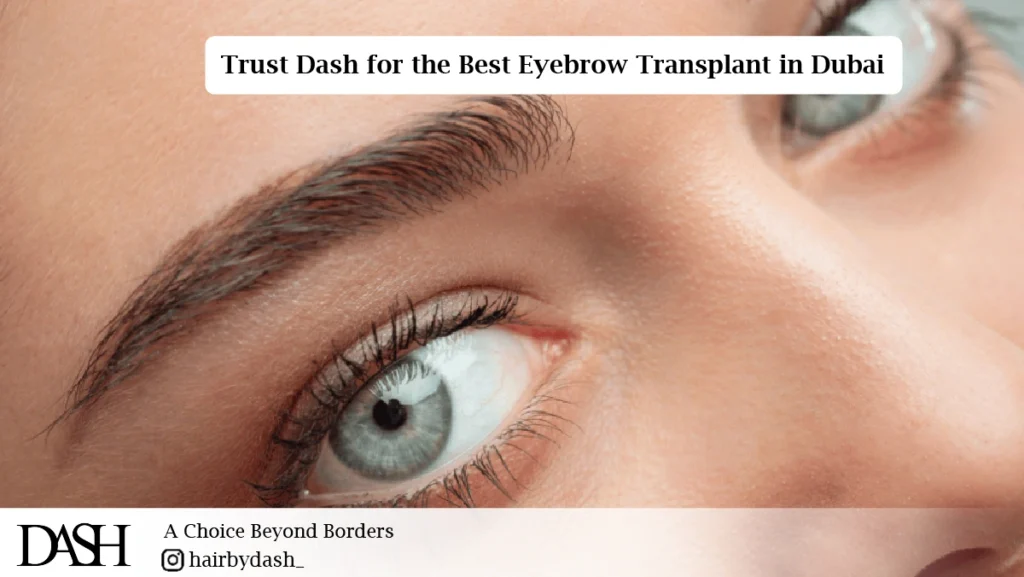 Trust Dash for the Best Eyebrow Transplant in Dubai