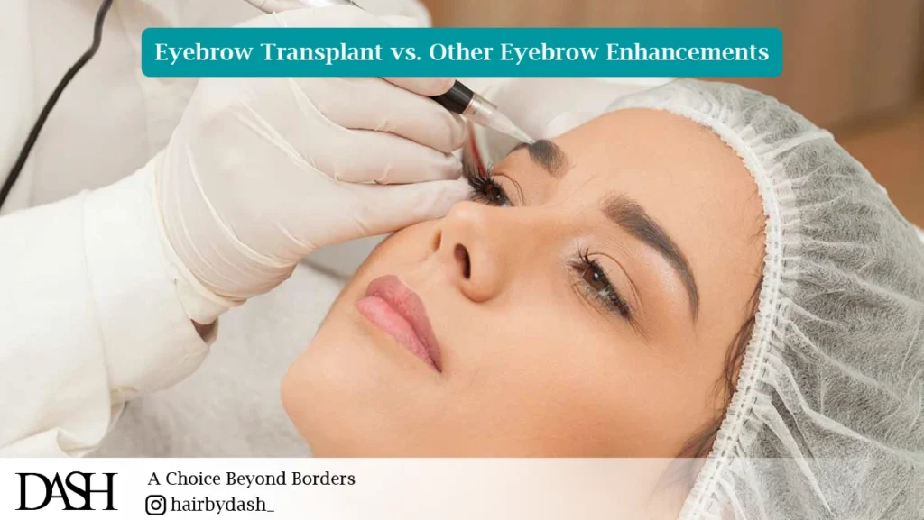 Eyebrow Transplant vs. Other Eyebrow Enhancements