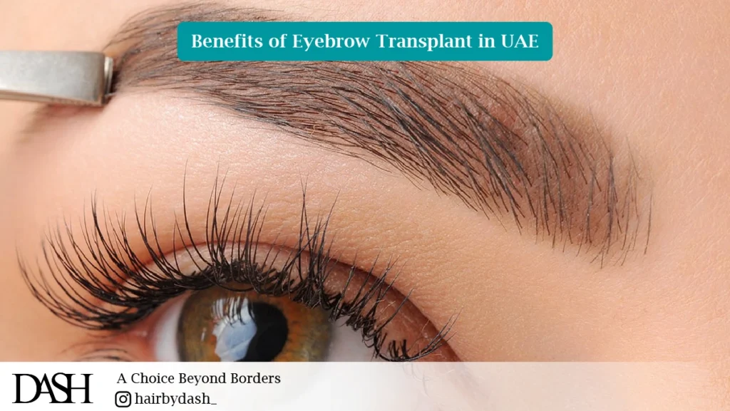 Benefits of Eyebrow Transplant in UAE