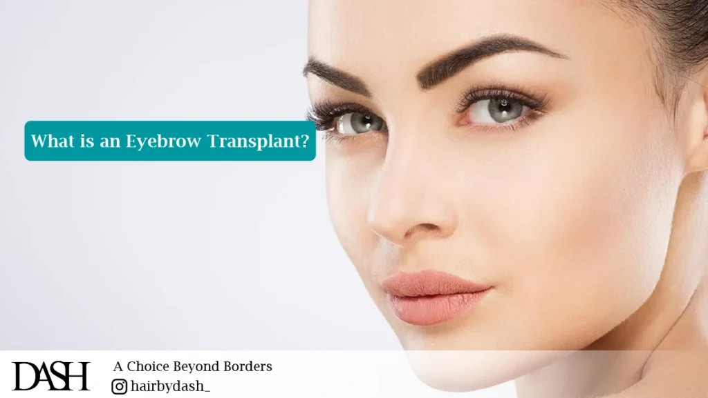 What is an Eyebrow Transplant?