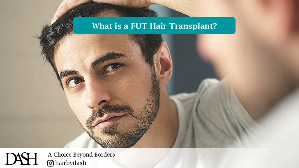 What is a FUT Hair Transplant?