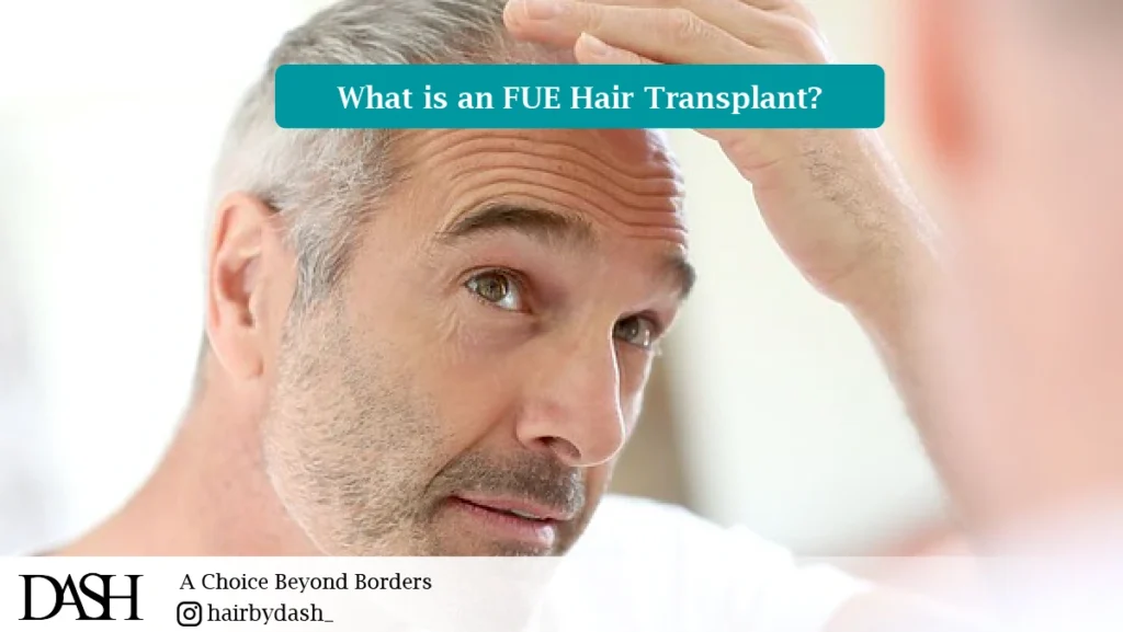 What is an FUE Hair Transplant?