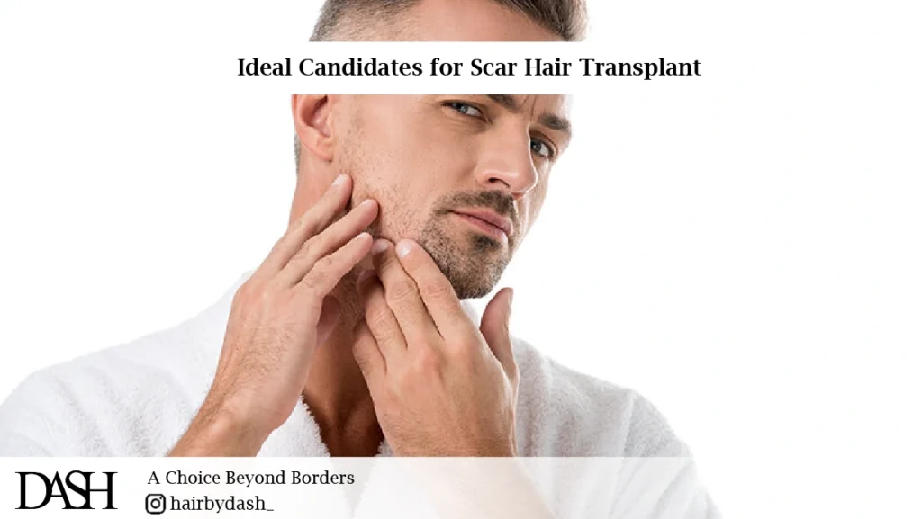 Hair Transplant for Burn and Scar Patients in Dubai-01