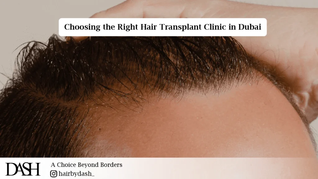 Receding Hairline Solutions-01