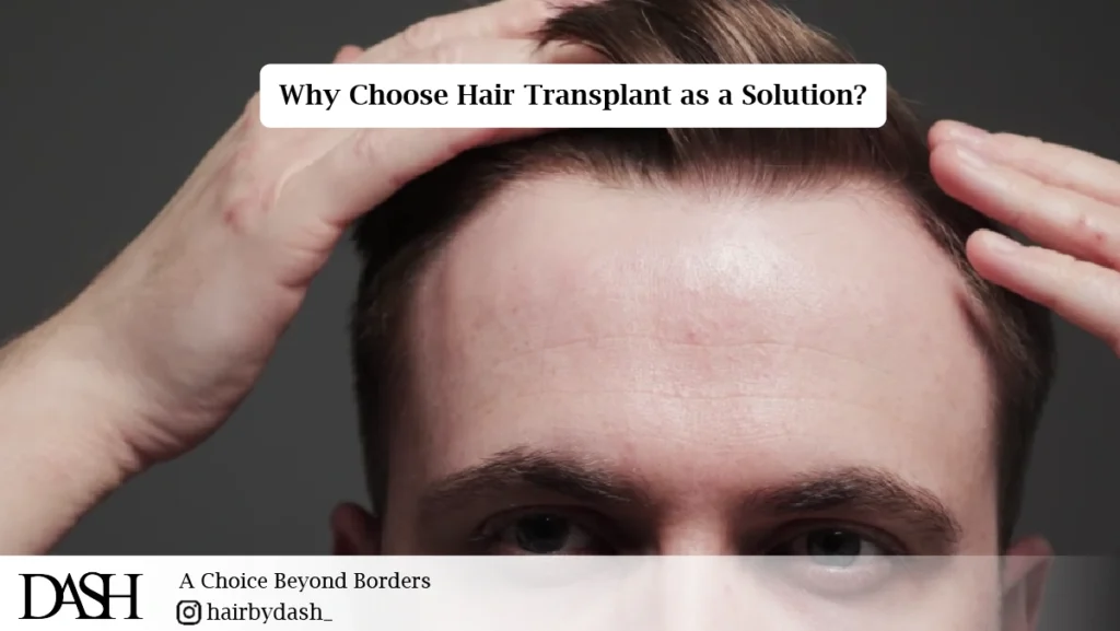Receding Hairline Solutions-01