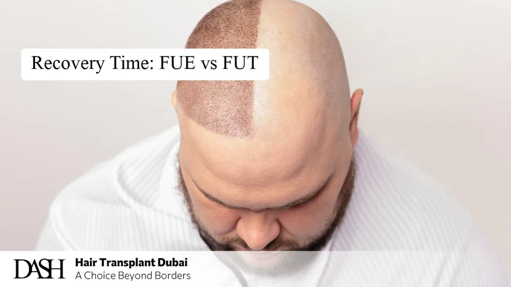 Recovery Time: FUE vs FUT