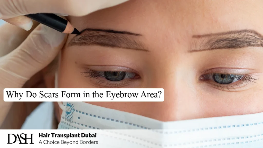 Why Do Scars Form in the Eyebrow Area?