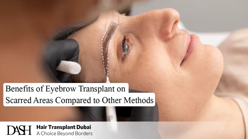 Benefits of Eyebrow Transplant on Scarred Areas Compared to Other Methods