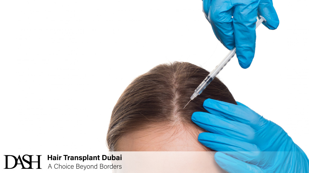Can Mesotherapy Stop Hair Loss? - Science & Results Explained