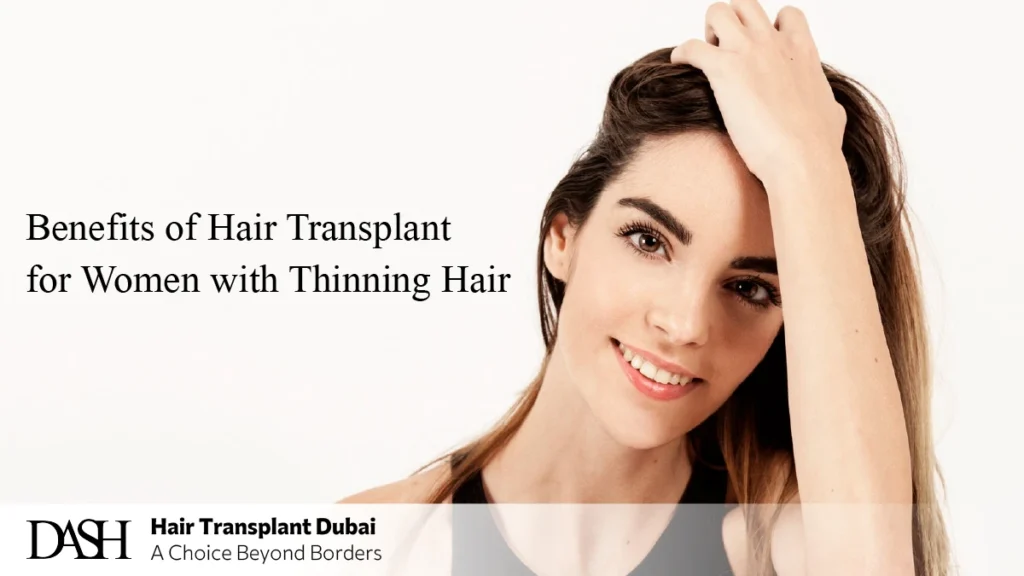 Benefits of Hair Transplant for Women with Thinning Hair