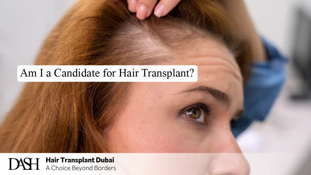 Am I a Candidate for Hair Transplant?