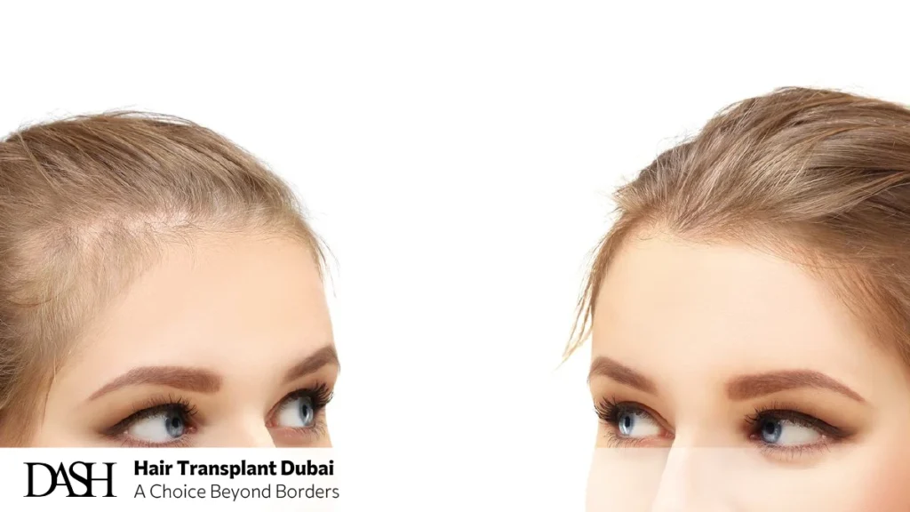 Before & After – Real Women, Real Confidence
