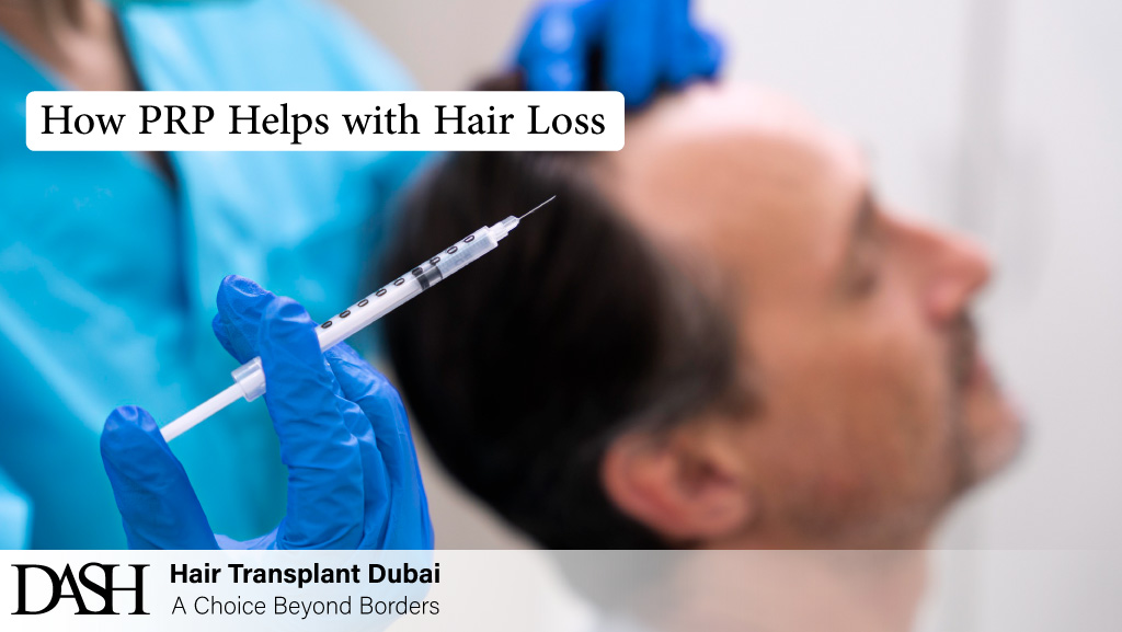 How PRP Helps with Hair Loss
