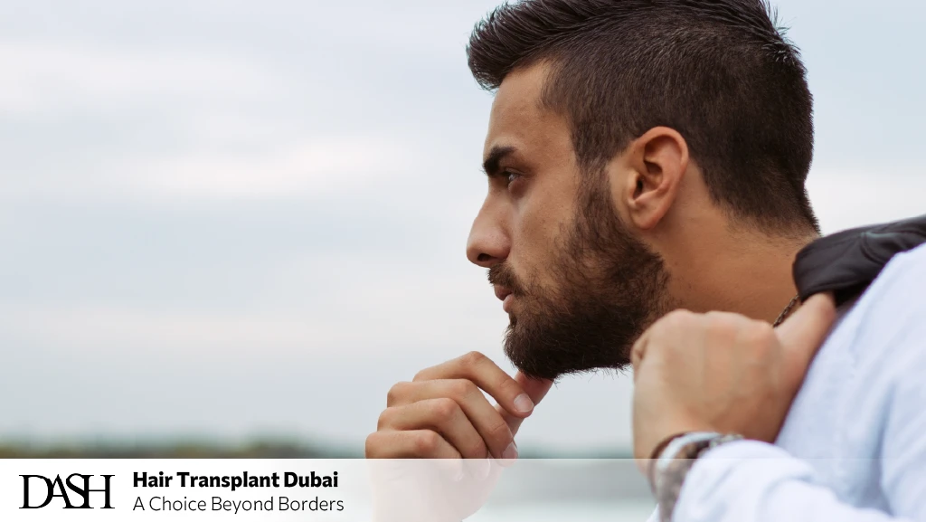 Hairline Correction in Dubai | Natural Hairline Design Techniques