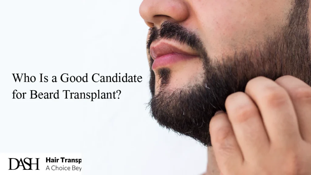 Who Is a Good Candidate for Beard Transplant?