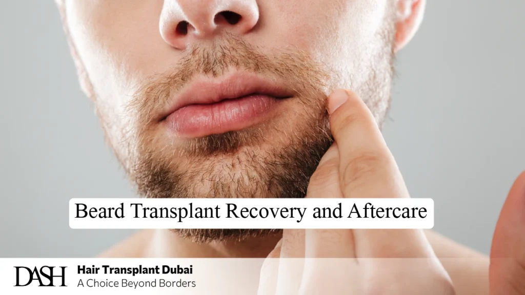 Beard Transplant Recovery and Aftercare: What to Expect Step by Step