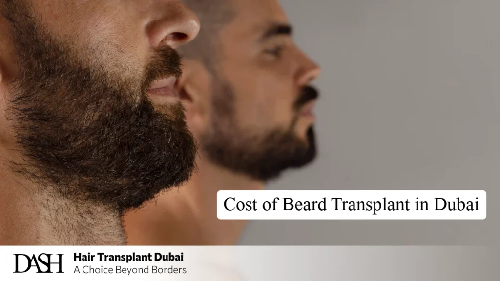 Cost of Beard Transplant in Dubai